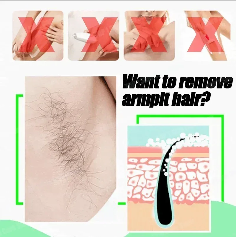 สเปรย์กำจัดขน กำจัดขนได้อย่างม - Hair Care Korean Products บทวิจารณ์และราคา